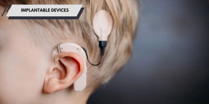 Implantable Devices