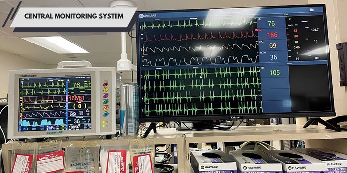 Central Monitoring System